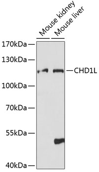CHD1L Rabbit pAb
