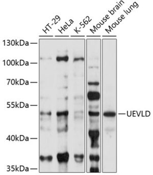 UEVLD Rabbit pAb