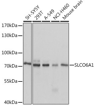SLCO6A1 Rabbit pAb
