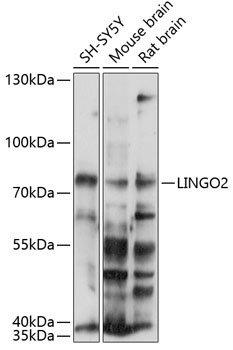 LINGO2 Rabbit pAb