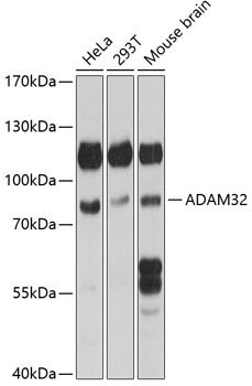 ADAM32 Rabbit pAb
