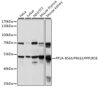 PP2A-B56δ/PR61δ/PPP2R5E Rabbit pAb