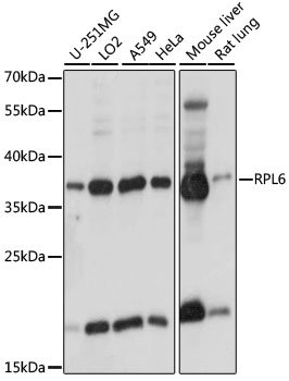 RPL6 Rabbit pAb