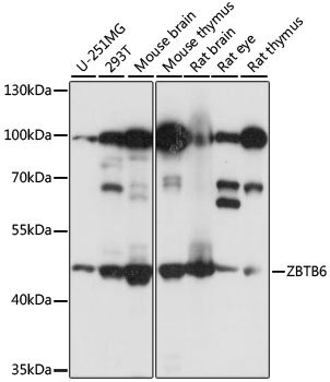 ZBTB6 Rabbit pAb