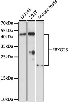 FBXO25 Rabbit pAb