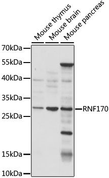 RNF170 Rabbit pAb