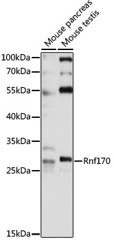 Rnf170 Rabbit pAb