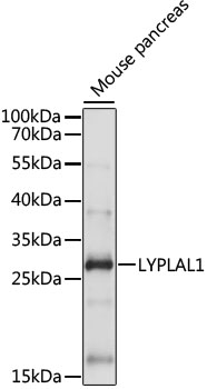 LYPLAL1 Rabbit pAb