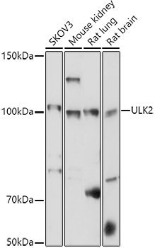 ULK2 Rabbit pAb