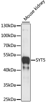 SYT5 Rabbit pAb