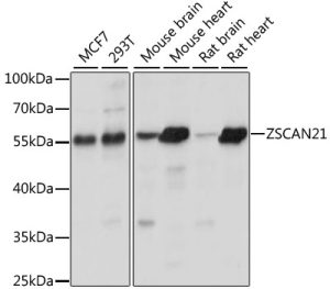 ZSCAN21 Rabbit pAb