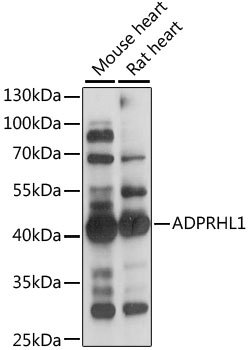 ADPRHL1 Rabbit pAb