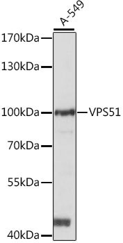VPS51 Rabbit pAb