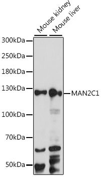 MAN2C1 Rabbit pAb