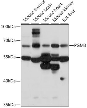 PGM3 Rabbit pAb