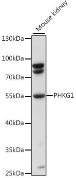 PHKG1 Rabbit pAb