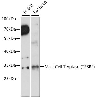 Mast Cell Tryptase (TPSB2) Rabbit pAb