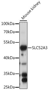 SLC52A3 Rabbit pAb