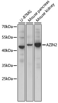 AZIN2 Rabbit pAb
