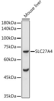 FATP4/SLC27A4 Rabbit pAb