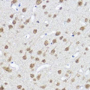 MYOCD Rabbit pAb