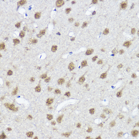 MYOCD Rabbit pAb