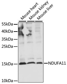 NDUFA11 Rabbit pAb
