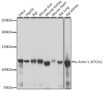 α-Actinin-4 Rabbit pAb