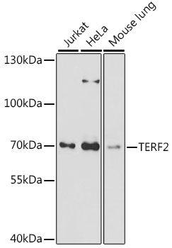 TERF2 Rabbit pAb