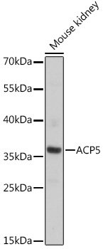 ACP5 Rabbit pAb
