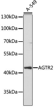 AGTR2 Rabbit pAb