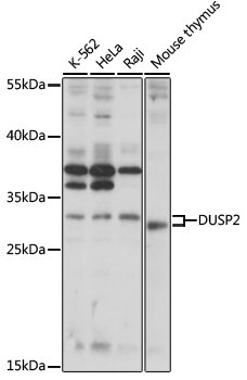 DUSP2 Rabbit pAb
