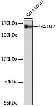 MATN2 Rabbit pAb