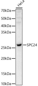 SPC24 Rabbit pAb