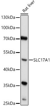 SLC17A1 Rabbit pAb