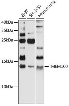 TMEM100 Rabbit pAb