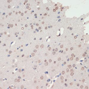 NEUROD1 Rabbit pAb