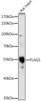 PLAG1 Rabbit pAb