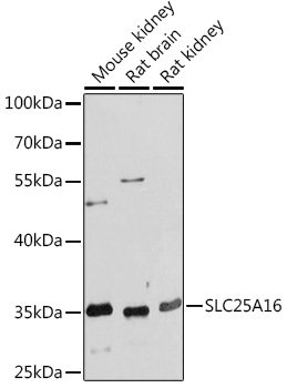 SLC25A16 Rabbit pAb