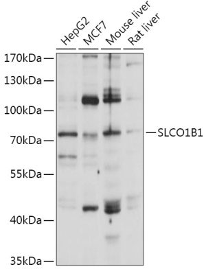 SLCO1B1 Rabbit pAb