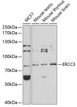 ERCC3 Rabbit pAb