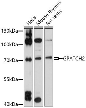GPATCH2 Rabbit pAb