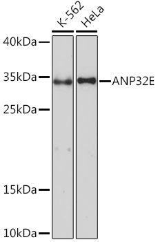 ANP32E Rabbit pAb