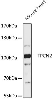 TPCN2 Rabbit pAb