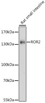 ROR2 Rabbit pAb