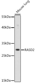 RASD2 Rabbit pAb