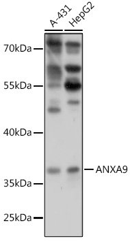 ANXA9 Rabbit pAb