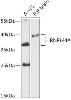 RNF144A Rabbit pAb
