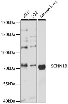 SCNN1B Rabbit pAb