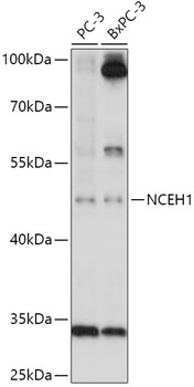NCEH1 Rabbit pAb